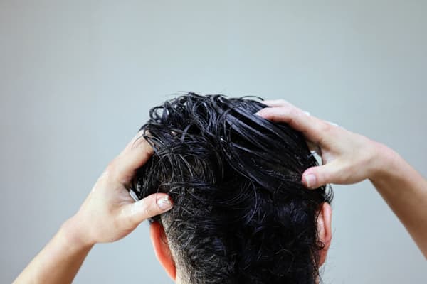 Male Pattern Baldness Cure