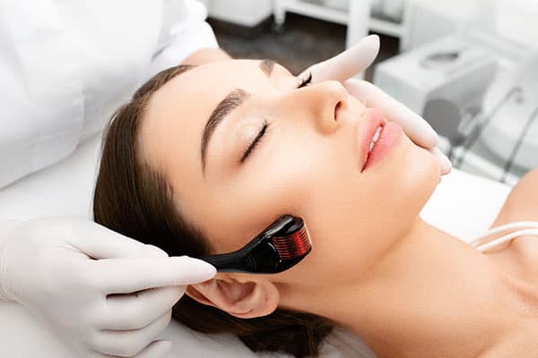 Microneedling