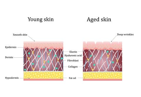 difference-betwwen-fine-lines-and-wrinkles-derma-essentia