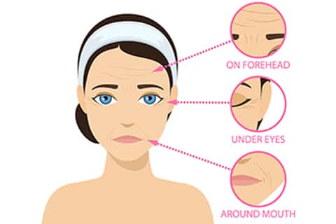 Tips to prevent wrinkles.. Worried about fine lines? Age spots