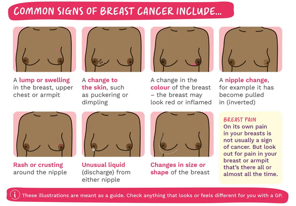 Check Your Breasts! – Fussy