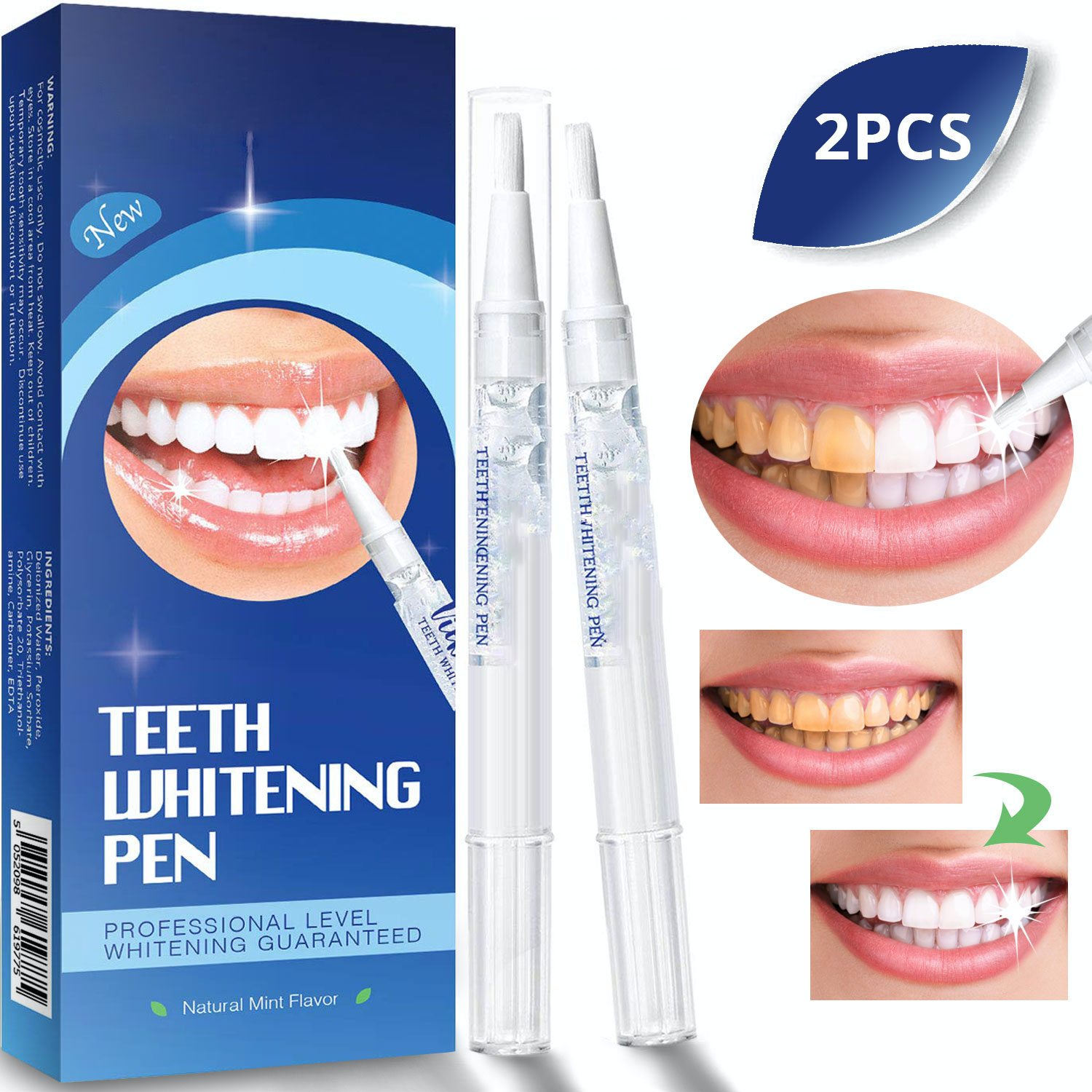 Teeth whitening kit. Teeth Whitening Systems. Yotuel Tooth Whitening Pen. Viebeauti отбеливающий отзывы. White & smile прймер для губ фото.