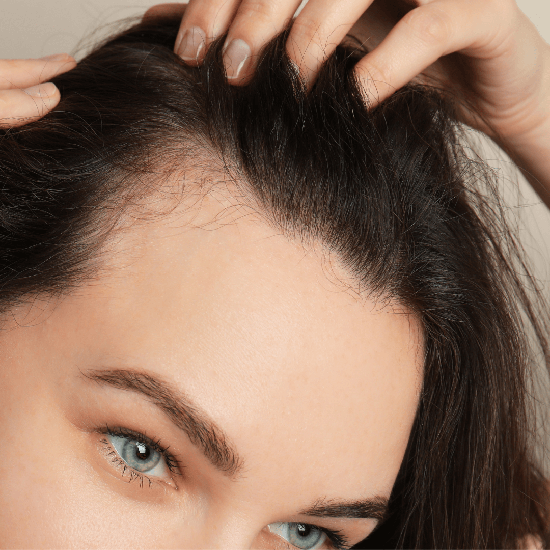 dormant hair follicles