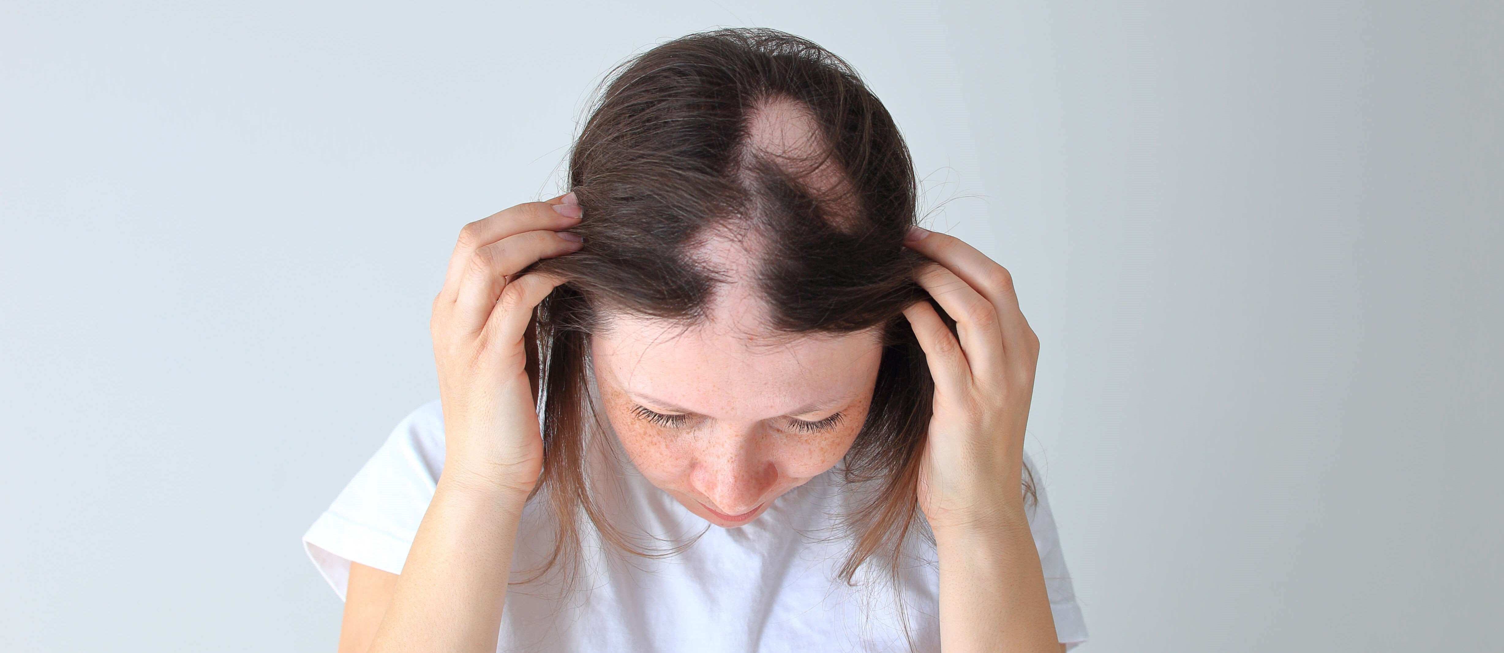 fighting hair loss ADOREYES