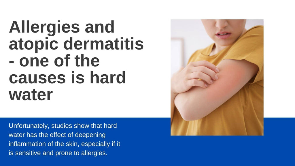 Allergies and atopic dermatitis