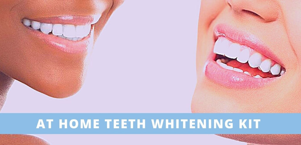 Image-at-home-teeth-whitening-kit