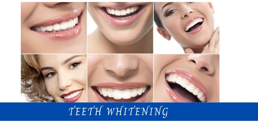 Image-teeth-whitening