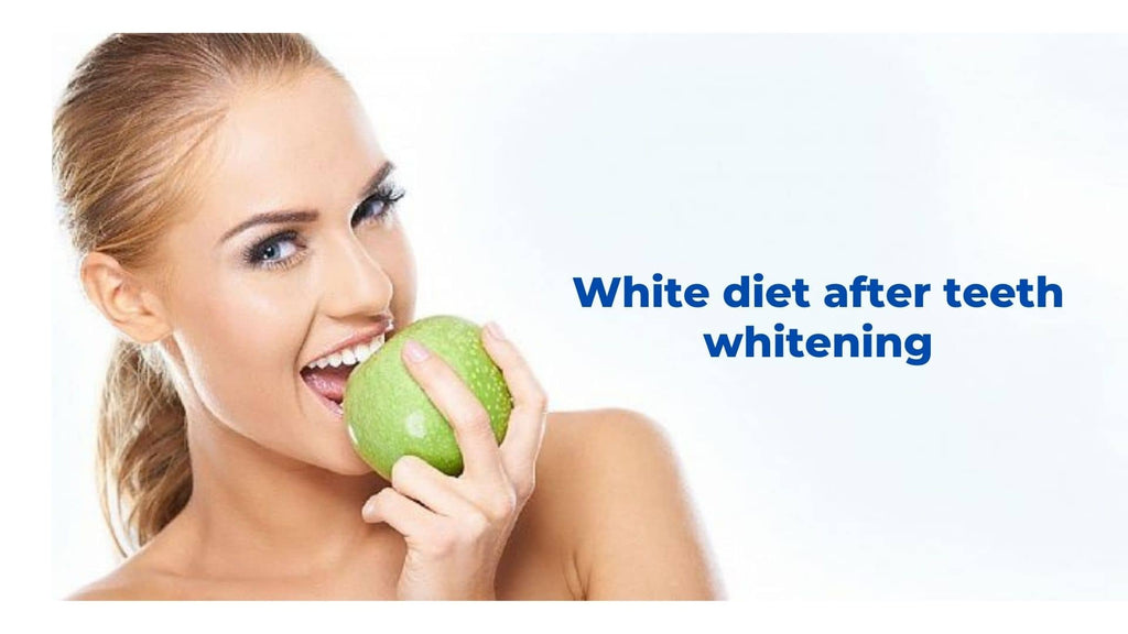 Image-white-diet-after-teeth-whitening