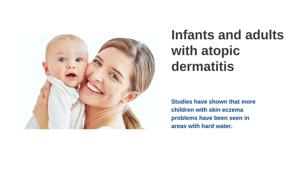 Infants and adults with atopic dermatitis
