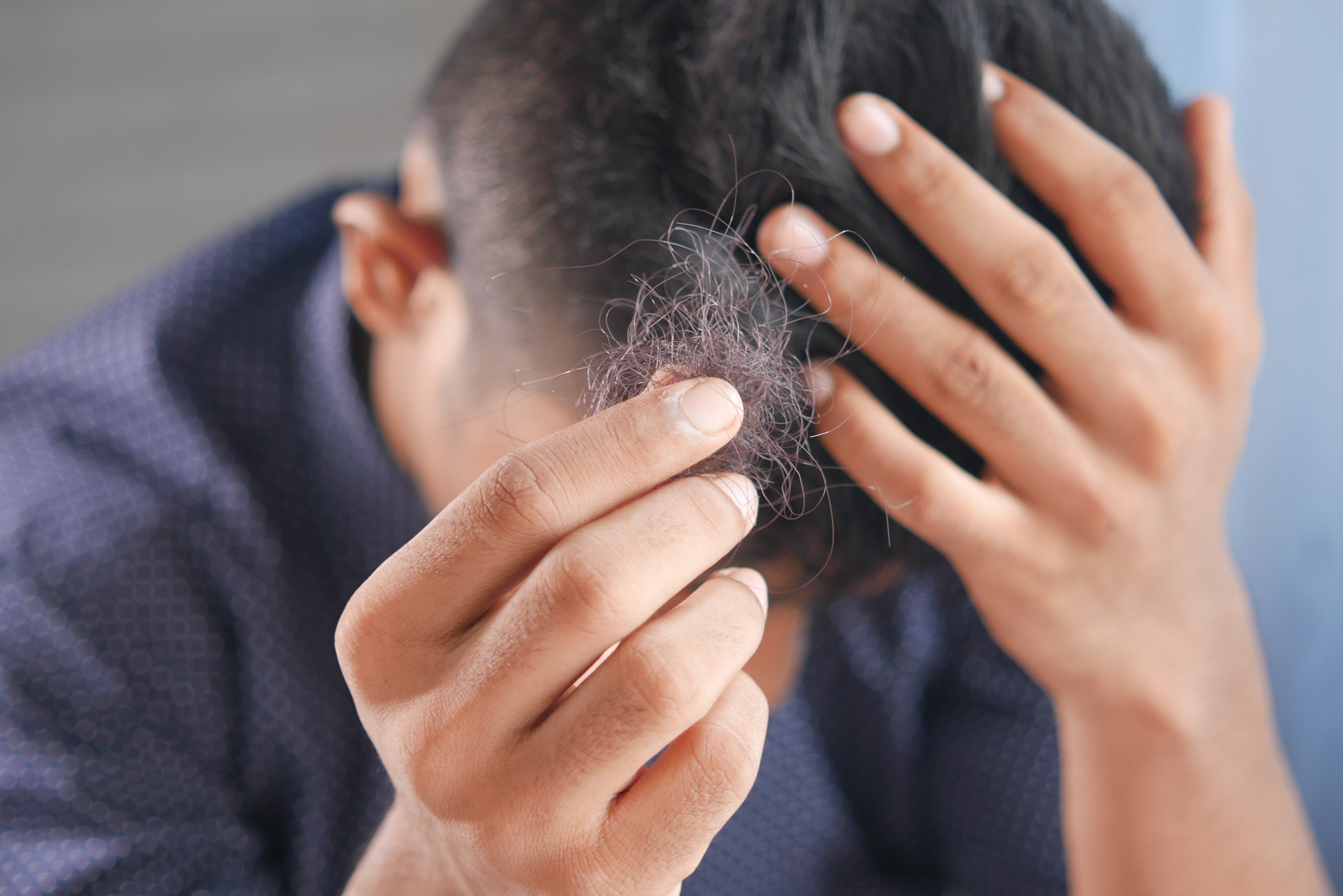 White Bulb At End Of Hair  What It Is and What You Can Do