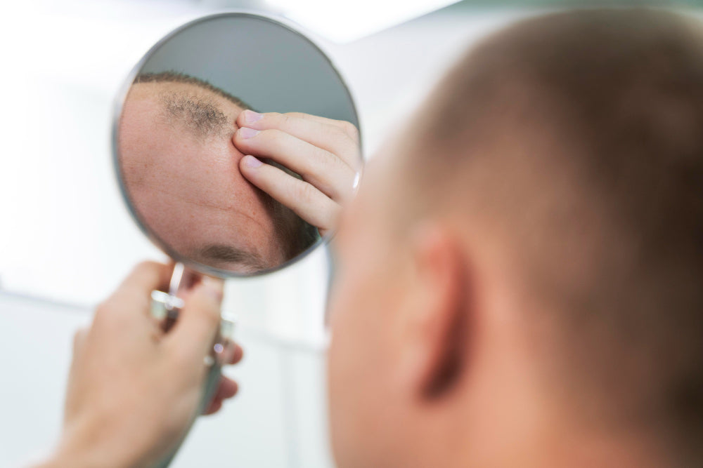 mounjaro side effects hair loss