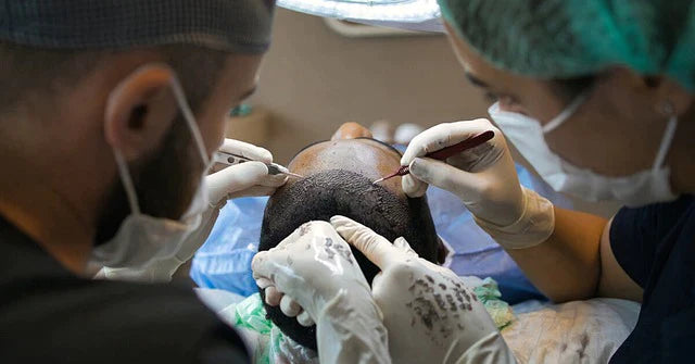 hair transplant for male and female pattern hair loss