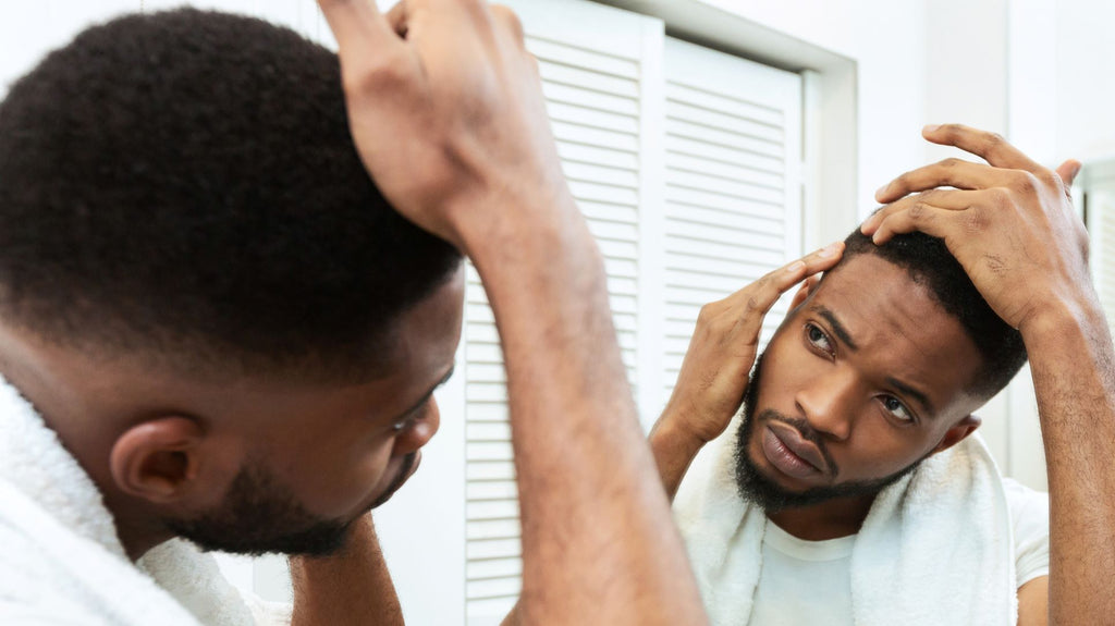 DHEA hair loss man in front of mirror