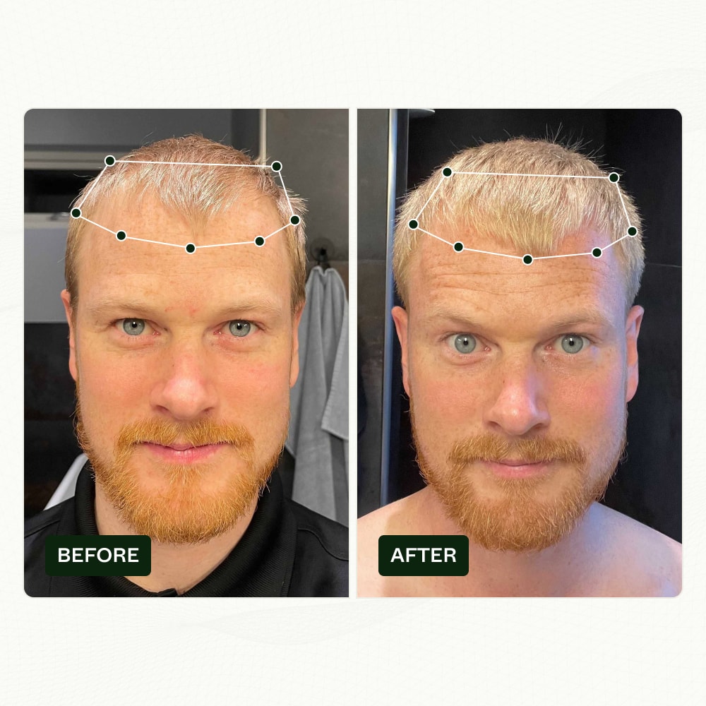 niels before and after results