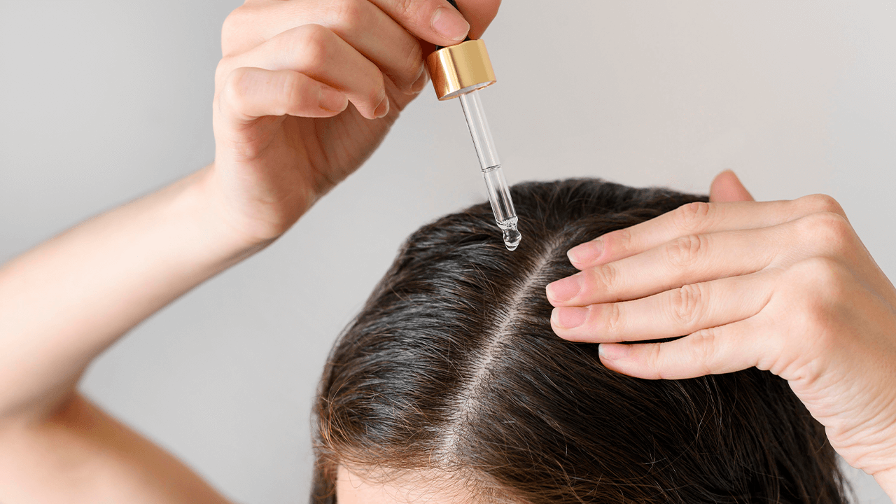 redensyl vs minoxidil to treat male pattern baldness