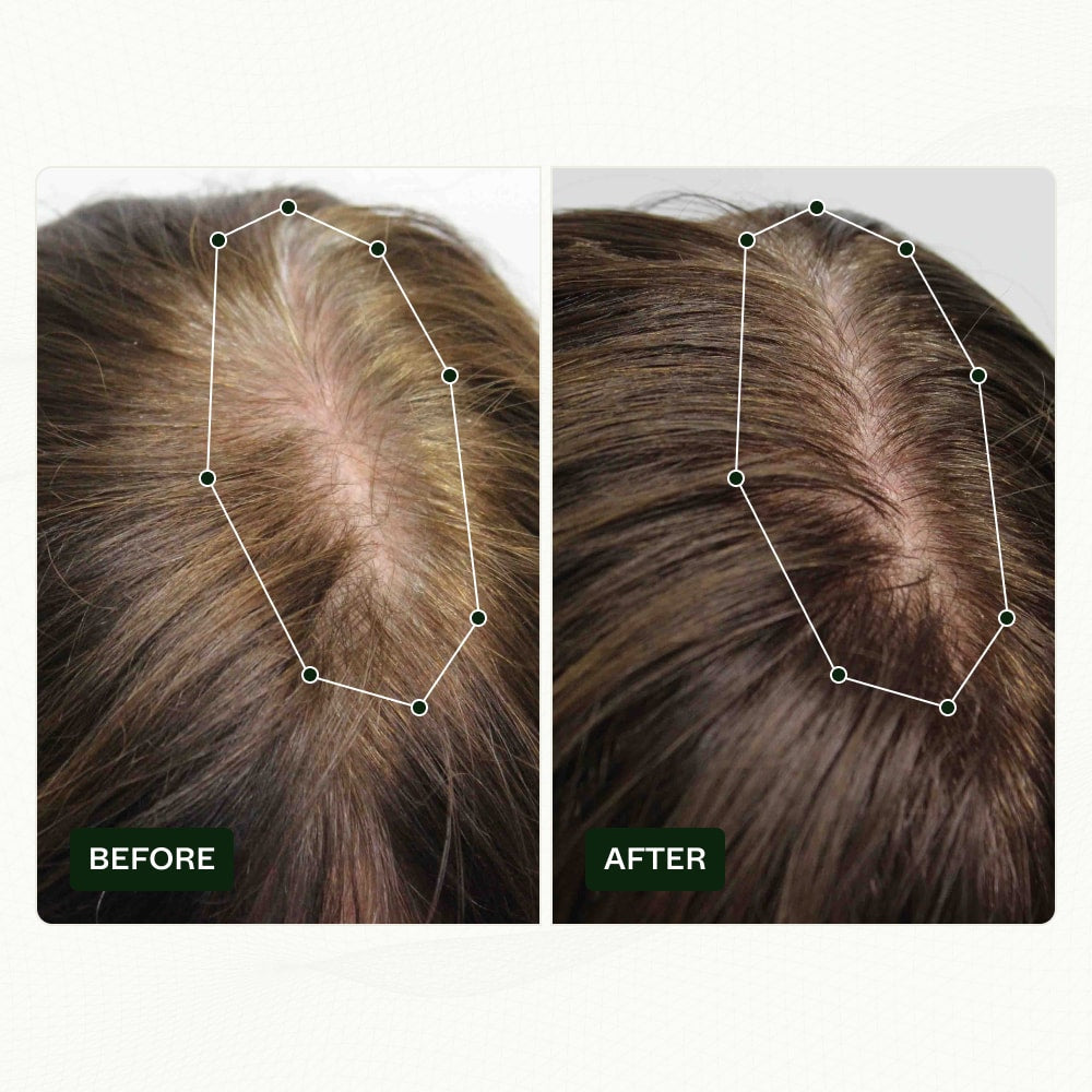 thin hair serum before and after results