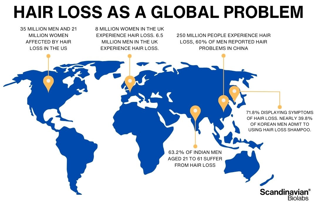 global hair loss statistics