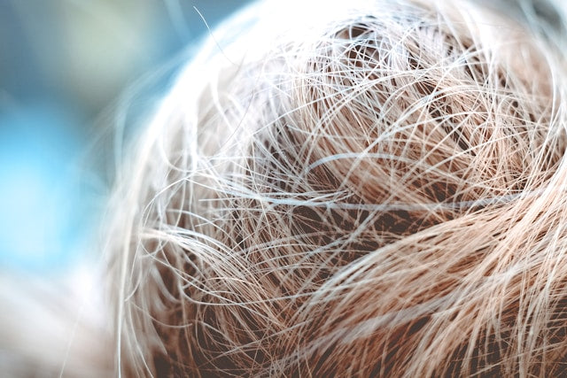 progesterone cream on scalp for hair loss