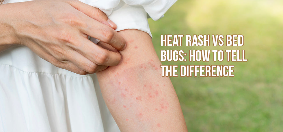 Hives Vs. Rash: How to Tell the Difference