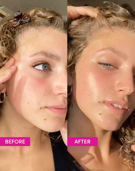 before and after image of girl with moisturiser