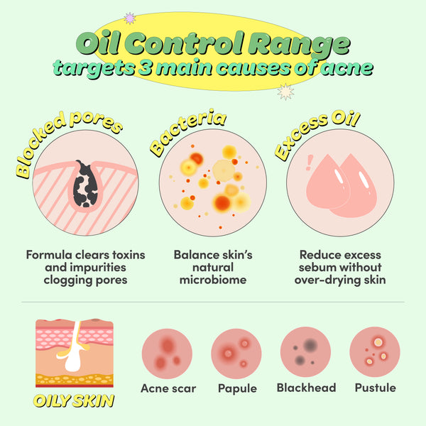 skincare infographic for acne