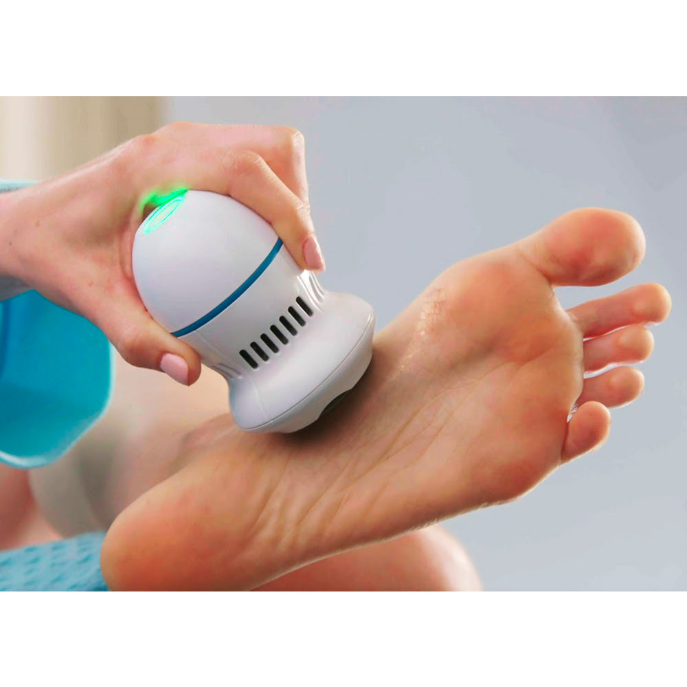 Rechargeable Callus Vacuum