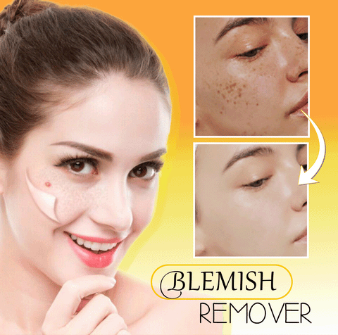 Instant Blemish Removal Gel – Peachy Trend