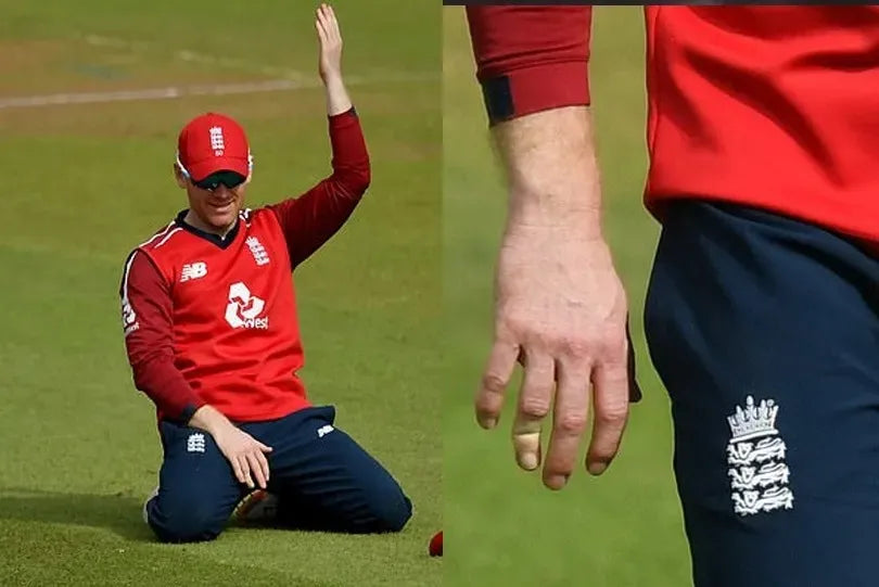 Eoin Morgan gets a finger broken from a cricket ball while fielding
