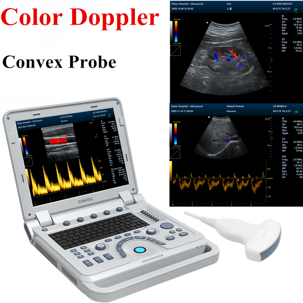 Scanner à ultrasons Doppler couleur WiFi mini-linéaire MLCD - SONOSIF