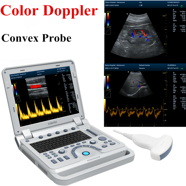 Fetal Heart Doppler LCD Pocket Prenatal Baby Sound Monitor Frequency 3MHz  Probe