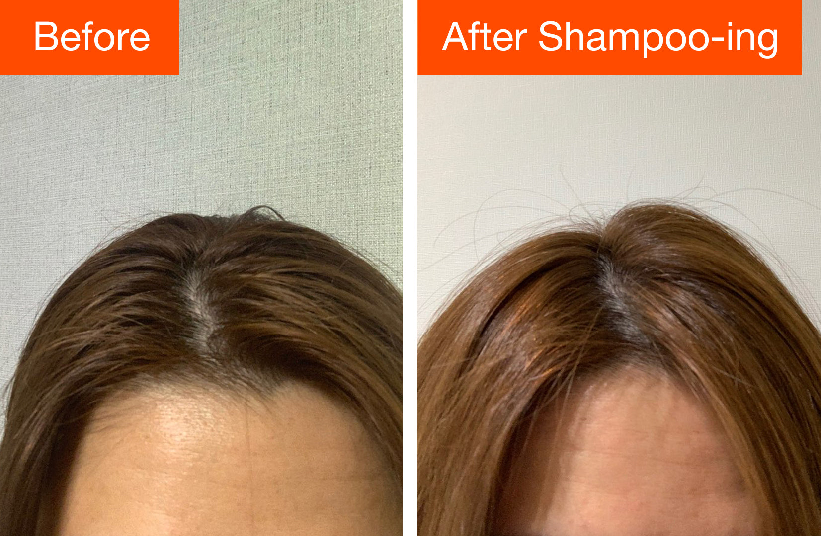 prevent oily hair with hair loss shampoo