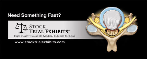 Cost effective medical exhibits in Florida