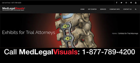 Exhibits for Trial Attorneys from MedLegalVisuals and Stock Trial Exhibits