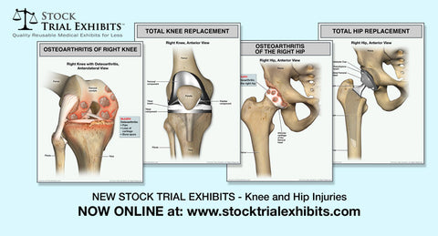 Medical Legal Stock Illustrations | Stock Medical Legal Illustrations 