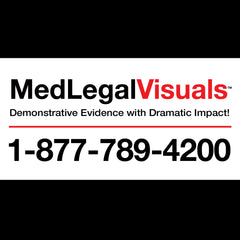 MedLegal Visuals - Custom Medical Legal Illustrations