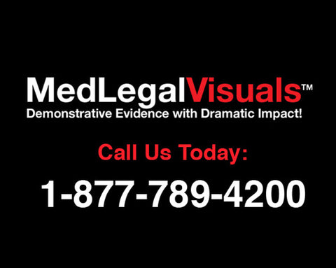 Medical Legal Exhibits Call 1-877-789-4200 only from MedLegalVisuals