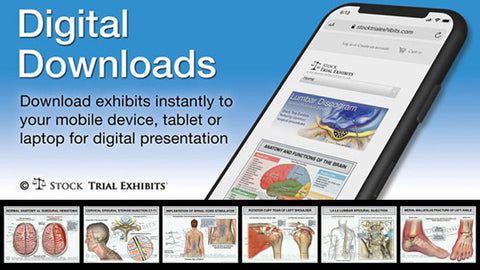 Stock Trial Exhibits - Cost Effective Medical Illustrations for Trial Attorneys used for all types of personal injury cases.