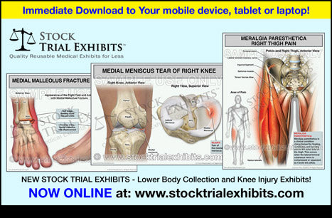 New Lower Body Collection of Stock Trial Exhibits - Now Online for immediate digital download