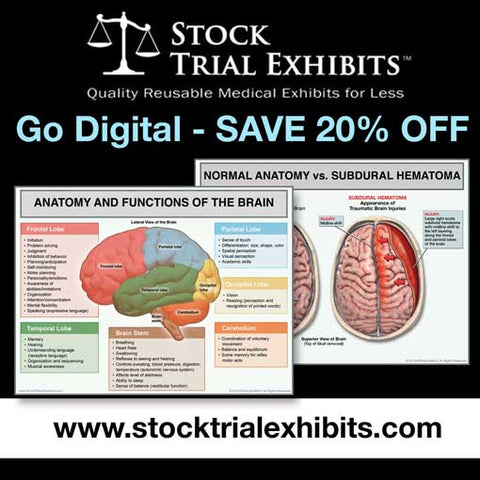 Digital Exhibits for Demand Packages and Mediation