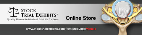 Download Medical Exhibits for Settlement Negotiations or Trial Presentation