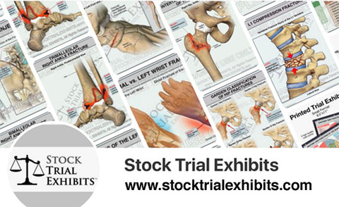 Anatomy Stock Images for Attorneys and Medical Professionals