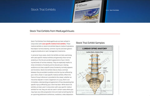 Medical Legal Visuals features Stock Trial Exhibits..