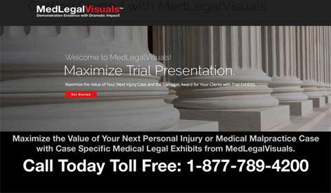 Trial Exhibits from Medical Legal Visuals