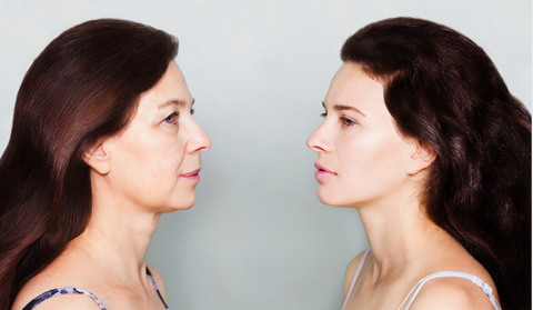 collagen loss effect with age in the skin