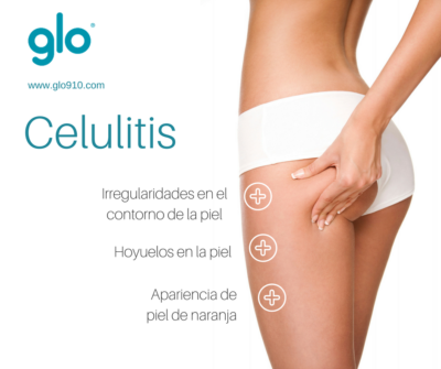 Celulitis y adiposidad localizada