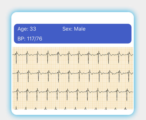 Ceas inteligent sanatate, ceas smart sanatate, ceas tensiune arteriala, ceas puls, ceas ECG, ceas monitorizare functii vitale, masoara si verifica: tensiunea arteriala, electrocardiograma (ECG), procentul de oxigen din sange, pulsul, temperatura, rata respiratorie și somnul. Aplicatie limba romana. Cel mai bun ceas tensiune arteriala.