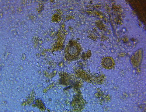 and the testate Amoeba (b) under water stress. 