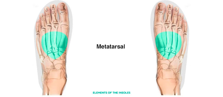 metatarsal pad for plantar fasciitis