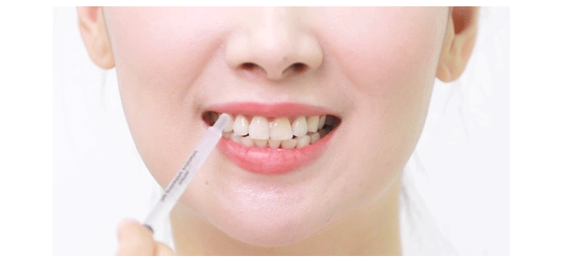 [Dentiluv] Intensive Whitening Gel