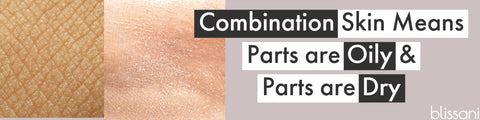 "combination skin means parts are oily and parts are dry" a picture of dry skin and a picture of oily skin